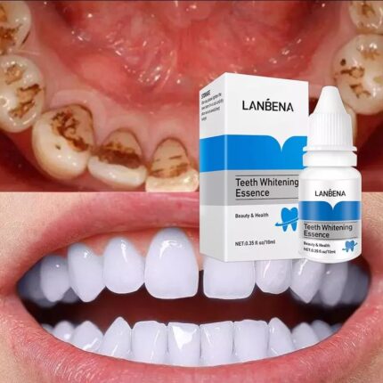 Teeth whitening essence
